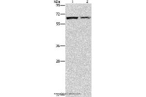 Western blot analysis of Mouse pancreas and human fetal liver tissue, using CBS Polyclonal Antibody at dilution of 1:550 (CBS Antikörper)