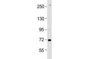 Western blot testing of HeLa cell lysate with ZDHHC17 antibody at 1:1000. (ZDHHC17 Antikörper  (AA 3-37))