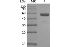 Western Blotting (WB) image for CD79b Molecule, Immunoglobulin-Associated beta (CD79B) protein (Fc Tag) (ABIN7321034) (CD79b Protein (Fc Tag))