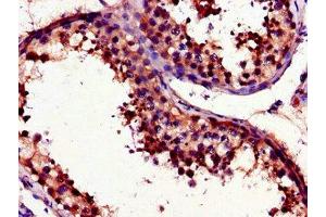 Immunohistochemistry of paraffin-embedded human testis tissue using ABIN7175097 at dilution of 1:100 (UNG Antikörper  (AA 114-224))