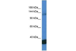 WB Suggested Anti-PPP1R12A AntibodyTitration: 1. (PPP1R12A Antikörper  (C-Term))