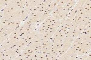 Immunohistochemistry (Paraffin-embedded Sections) (IHC (p)) image for anti-TP53RK Binding Protein (TPRKB) antibody (ABIN7075943)