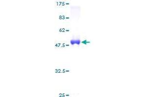 Ubiquitin Domain Containing 2 (UBTD2) (AA 1-190) protein (GST tag)