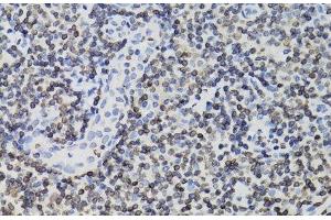 Immunohistochemistry of paraffin-embedded Human tonsil using TMPO Polyclonal Antibody at dilution of 1:100 (40x lens). (Thymopoietin Antikörper)