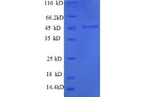 SDS-PAGE (SDS) image for Matrix Metallopeptidase 1 (Interstitial Collagenase) (MMP1) (AA 101-469), (partial) protein (His tag) (ABIN4976403) (MMP1 Protein (AA 101-469, partial) (His tag))