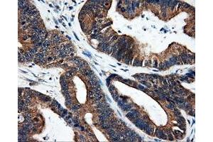 Immunohistochemical staining of paraffin-embedded liver tissue using anti-SRRmouse monoclonal antibody. (SRR Antikörper)