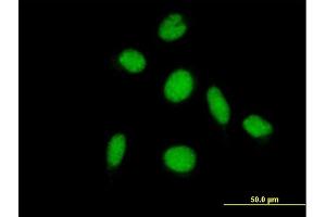 Immunofluorescence of purified MaxPab antibody to PIAS2 on HeLa cell. (PIAS2 Antikörper  (AA 1-572))