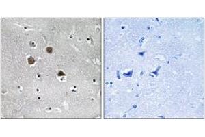Immunohistochemistry analysis of paraffin-embedded human brain tissue, using MARK1/2/3/4 (Ab-215) Antibody. (MARK1/2/3/4 Antikörper  (AA 181-230))