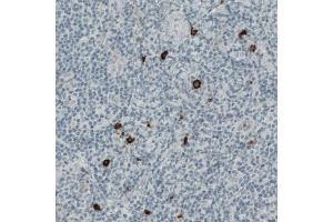 Immunohistochemical staining (Formalin-fixed paraffin-embedded sections) of human tonsil with KIT monoclonal antibody, clone CL1667  shows strong positivity in a subset of lymphoid cells. (KIT Antikörper  (AA 50-190))