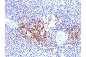 Formalin-fixed, paraffin-embedded human Spleen stained with TRAF1 Mouse Monoclonal Antibody (TRAF1/2770). (TRAF1 Antikörper  (AA 73-219))
