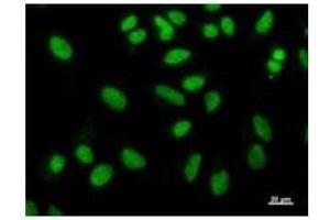 Immunostaining analysis in HeLa cells. (NAB1 Antikörper)