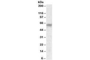 Western blot testing of human testis lysate with TTC8 antibody at 0. (TTC8 Antikörper)