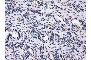 Immunohistochemical staining of paraffin-embedded colon tissue using anti-GBE1mouse monoclonal antibody. (GBE1 Antikörper)
