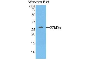 Western Blotting (WB) image for anti-Prostate Specific Antigen (PSA) (AA 39-261) antibody (ABIN3209161)