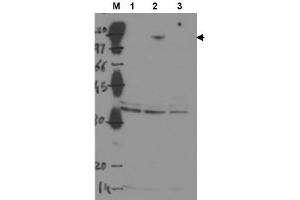 Image no. 1 for anti-Tumor Protein P53 Binding Protein 2 (TP53BP2) antibody (ABIN401045) (TP53BP2 Antikörper)
