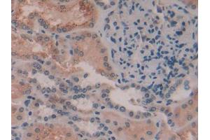 DAB staining on IHC-P; Samples: Human Kidney Tissue (AMBP Antikörper  (AA 22-203))
