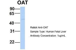 Host:  Rabbit  Target Name:  OAT  Sample Type:  Human Fetal Liver  Antibody Dilution:  1. (OAT Antikörper  (Middle Region))