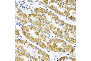 Immunohistochemistry of paraffin-embedded human stomach using POLG2 antibody (ABIN5974040) at dilution of 1/100 (40x lens). (POLG2 Antikörper)