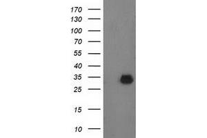 Western Blotting (WB) image for anti-Phenylethanolamine N-Methyltransferase (PNMT) antibody (ABIN1500309) (PNMT Antikörper)