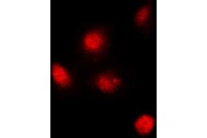 Immunofluorescent analysis of SUPT3H staining in MCF7 cells. (SUPT3H/SPT3 Antikörper  (Center))