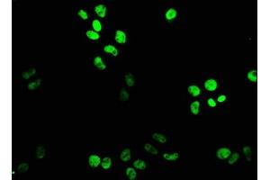Immunofluorescence staining of PC-3 cells with ABIN7164186 at 1:133, counter-stained with DAPI. (XAB2 Antikörper  (AA 750-840))