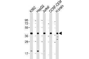 All lanes : Anti-Cyclophilin D Antibody at 1:2000 dilution Lane 1: K562 whole cell lysate Lane 2: HepG2 whole cell lysate Lane 3: Jurkat whole cell lysate Lane 4: CCRF-CEM whole cell lysate Lane 5: human brain lysate Lysates/proteins at 20 μg per lane.