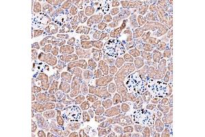 IHC analysis of p57 Kip2/CDKN1C using anti-p57 Kip2/CDKN1C antibody (ABIN7603232).