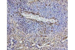 IHC analysis of CD43 using anti-CD43 antibody (ABIN7601042). (CD43 Antikörper  (AA 272-400))