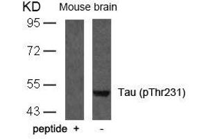 Western blot analysis of extracts from mouse brain tissue using Tau(Phospho-Thr231) Antibody and the same antibody preincubated with blocking peptide. (MAPT Antikörper  (pThr231))