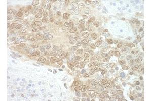 Immunohistochemistry (IHC) image for anti-RuvB-Like 2 (E. Coli) (RUVBL2) (AA 1-50) antibody (ABIN7448783)