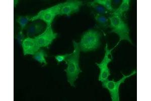 Anti-DYNC1LI1 mouse monoclonal antibody (ABIN2452964) immunofluorescent staining of COS7 cells transiently transfected by pCMV6-ENTRY DYNC1LI1 (RC222010). (DYNC1LI1 Antikörper)