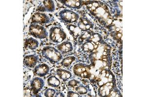 IHC analysis of Hexokinase 1/HK1 using anti-Hexokinase 1/HK1 antibody (ABIN7600259). (Hexokinase 1 Antikörper  (AA 17-323))