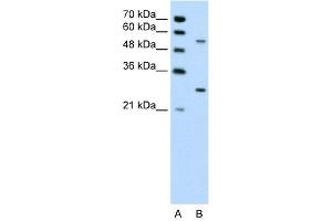 WB Suggested Anti-PDPK1 Antibody Titration: 0. (PDPK1 Antikörper  (Middle Region))