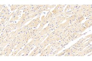 Immunohistochemistry (IHC) image for anti-Heparan Sulfate Proteoglycan 2 (HSPG2) (AA 4149-4391) antibody (ABIN7435115)