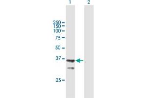 Western Blot analysis of AGMAT expression in transfected 293T cell line by AGMAT MaxPab polyclonal antibody. (AGMAT Antikörper  (AA 1-352))