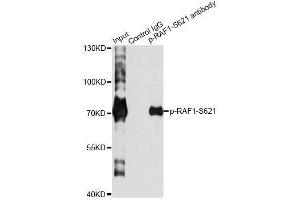 Immunoprecipitation analysis of 200 μg extracts of HeLa cells treated by EGF using 2. (RAF1 Antikörper  (pSer621))