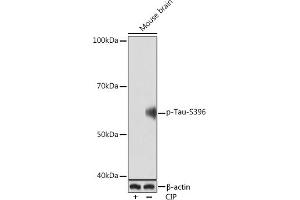 Western blot analysis of extracts of Mouse brain, using Phospho-Tau-S396 Rabbit mAb (ABIN7268523) at 1:1000 dilution. (MAPT Antikörper  (pSer396))