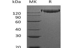 Western Blotting (WB) image for Sema Domain, Immunoglobulin Domain (Ig), Transmembrane Domain (TM) and Short Cytoplasmic Domain, (Semaphorin) 4D (SEMA4D) protein (Fc Tag) (ABIN7320711) (SEMA4D/CD100 Protein (Fc Tag))