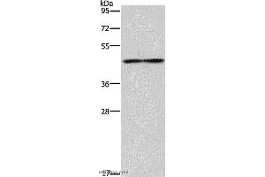 Western blot analysis of Mouse heart tissue, using IL5RA Polyclonal Antibody at dilution of 1:550 (IL5RA Antikörper)
