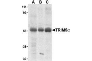 Western blot analysis of TRIM5 alpha expression in human stomach (A), thymus (B), and uterus (C) cell lysate with this product at 2 μg /ml. (TRIM5 Antikörper  (Isoform alpha, Middle Region))