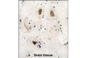 Formalin-fixed and paraffin-embedded human brain tissue reacted with ROR2 antibody, which was peroxidase-conjugated to the secondary antibody, followed by DAB staining. (ROR2 Antikörper)