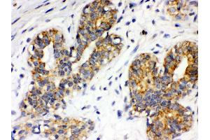 Anti- Integrin alpha 4 Picoband antibody, IHC(P) IHC(P): Human Mammary Cancer Tissue (ITGA4 Antikörper  (C-Term))