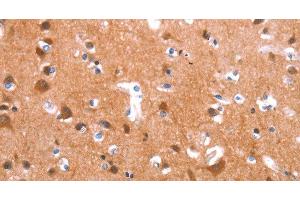 Immunohistochemistry of paraffin-embedded Human brain tissue using GAS8 Polyclonal Antibody at dilution 1:40 (GAS8 Antikörper)