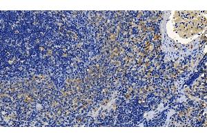 Immunohistochemistry (IHC) image for anti-Transforming Growth Factor, beta 1 (TGFB1) (AA 279-390) antibody (ABIN7429469)