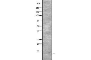 Western blot analysis of ACYP2 using K562 whole cell lysates (Acyp2 Antikörper  (Internal Region))