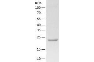 Western Blotting (WB) image for Insulin-Like Growth Factor 2 mRNA Binding Protein 2 (IGF2BP2) (AA 1-220) protein (His tag) (ABIN7123455) (IGF2BP2 Protein (AA 1-220) (His tag))