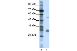 WB Suggested Anti-LRRC14 Antibody Titration:  0. (LRRC14 Antikörper  (C-Term))