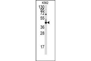 Image no. 1 for anti-BCL2-Like 14 (Apoptosis Facilitator) (BCL2L14) (BH3 Domain), (Isoform 3) antibody (ABIN356813)