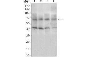 Western blot analysis using ABCG5 mouse mAb against HepG2 (1), HeLa (2), Jurkat (3), and Lovo (4) cell lysate. (ABCG5 Antikörper  (AA 306-367))