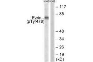 Image no. 1 for anti-Ezrin (EZR) (AA 446-495), (pTyr478) antibody (ABIN1532010) (Ezrin Antikörper  (pTyr478))